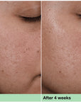 CLINQUE Smart clinical repair wrinkle correcting rich cream